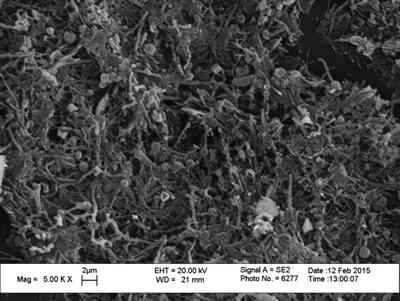 Biofilm growth and microbial contamination of dental unit waterlines at Kuwait University dental center